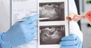 Sve što treba da znate o abortusu: Prekid trudnoće, kiretaža i pilule za abortus